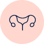 Cancro do Ovário